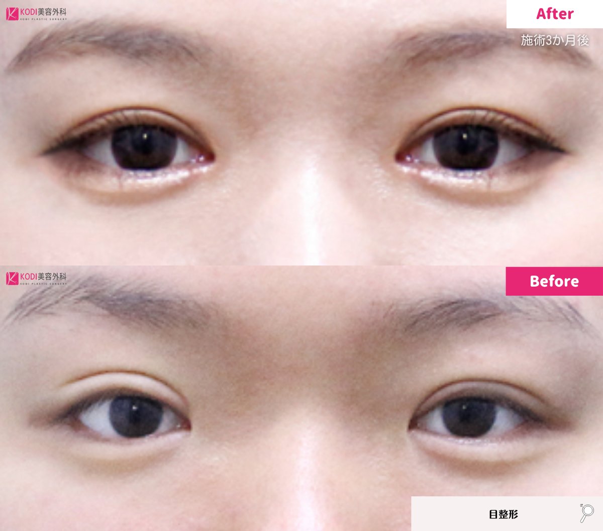 KODI美容外科💖江南でフィラーするならコディ💖 tweet media