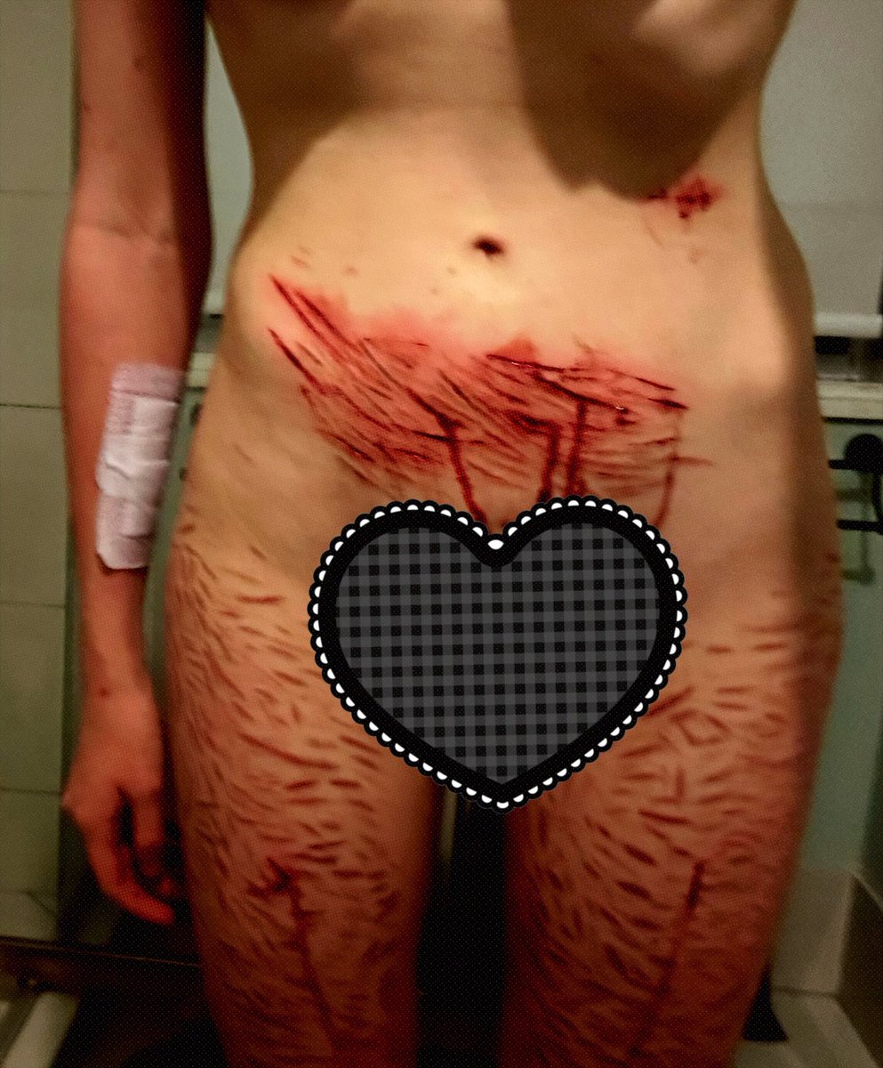 N3cro_K1tty🎀SHEDtwt tweet media