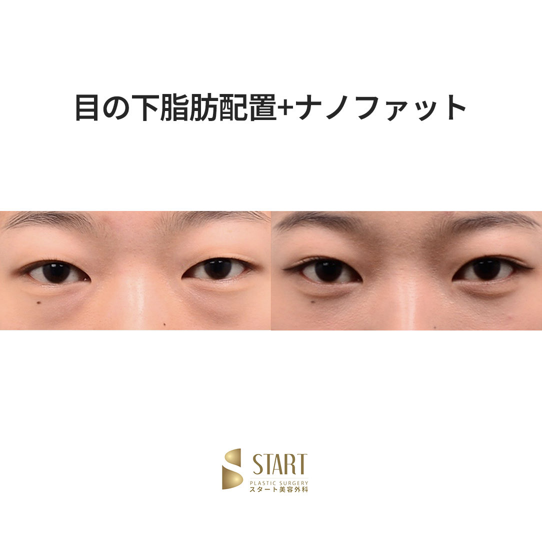 スタート整形外科 tweet media