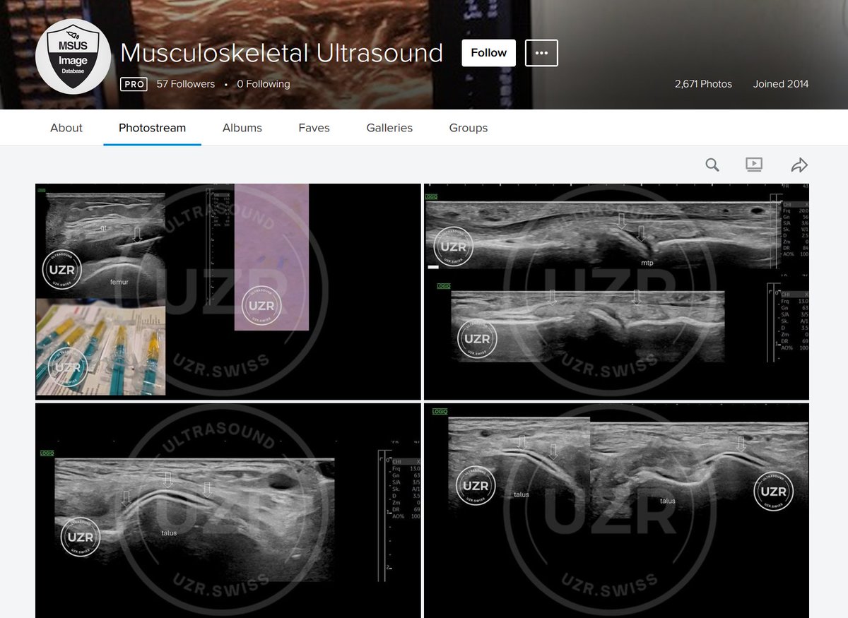 Rheumatology's tweet photo. We now have more than 2600 images and videos in the FREE MSUS Database!
https://t.co/ddUAKphI6O
______________
Video Channel https://t.co/WKqhWUWnLL
Textbook: https://t.co/ZstTDdf38P https://t.co/zGCFXy2liQ
