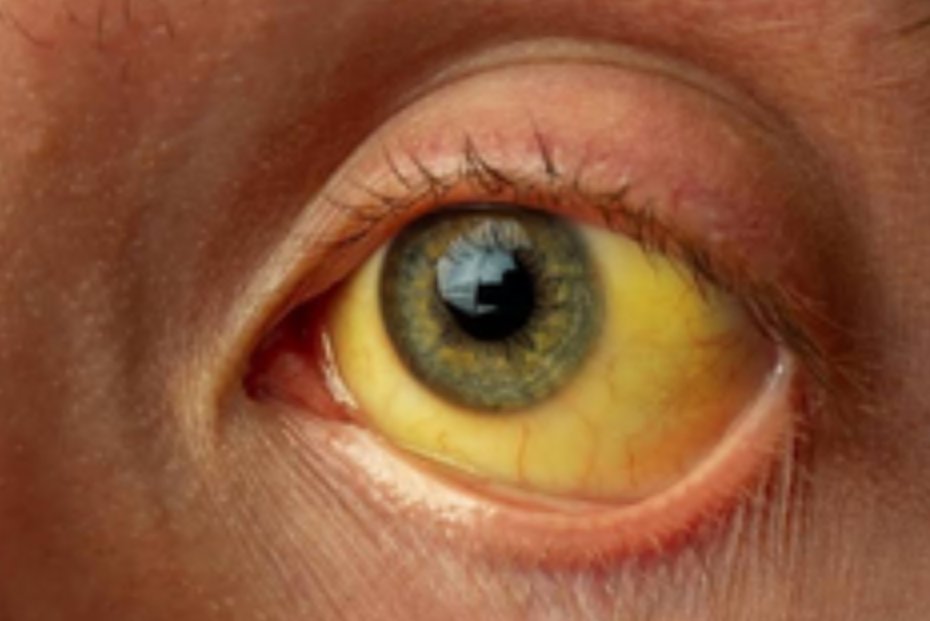 Elin Zoya tweet media