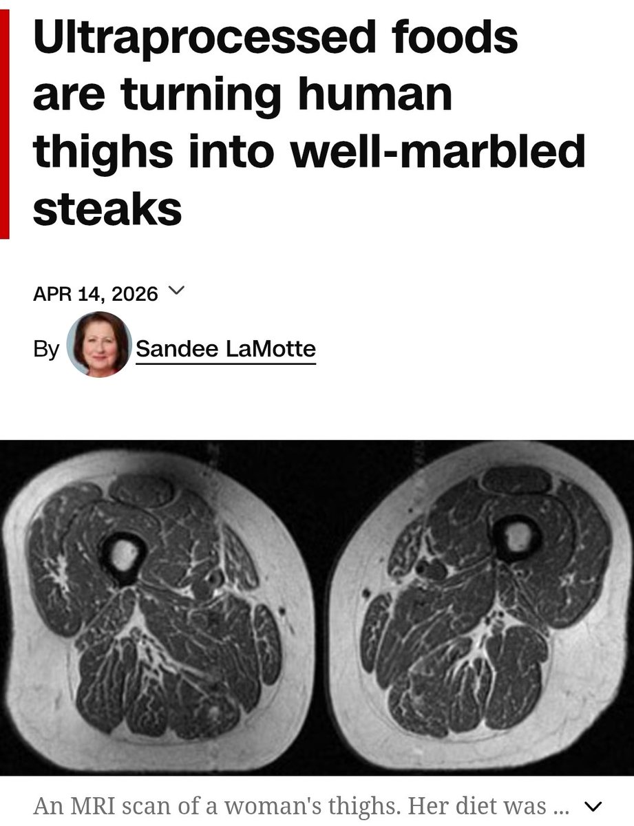 잿달/IRO tweet media