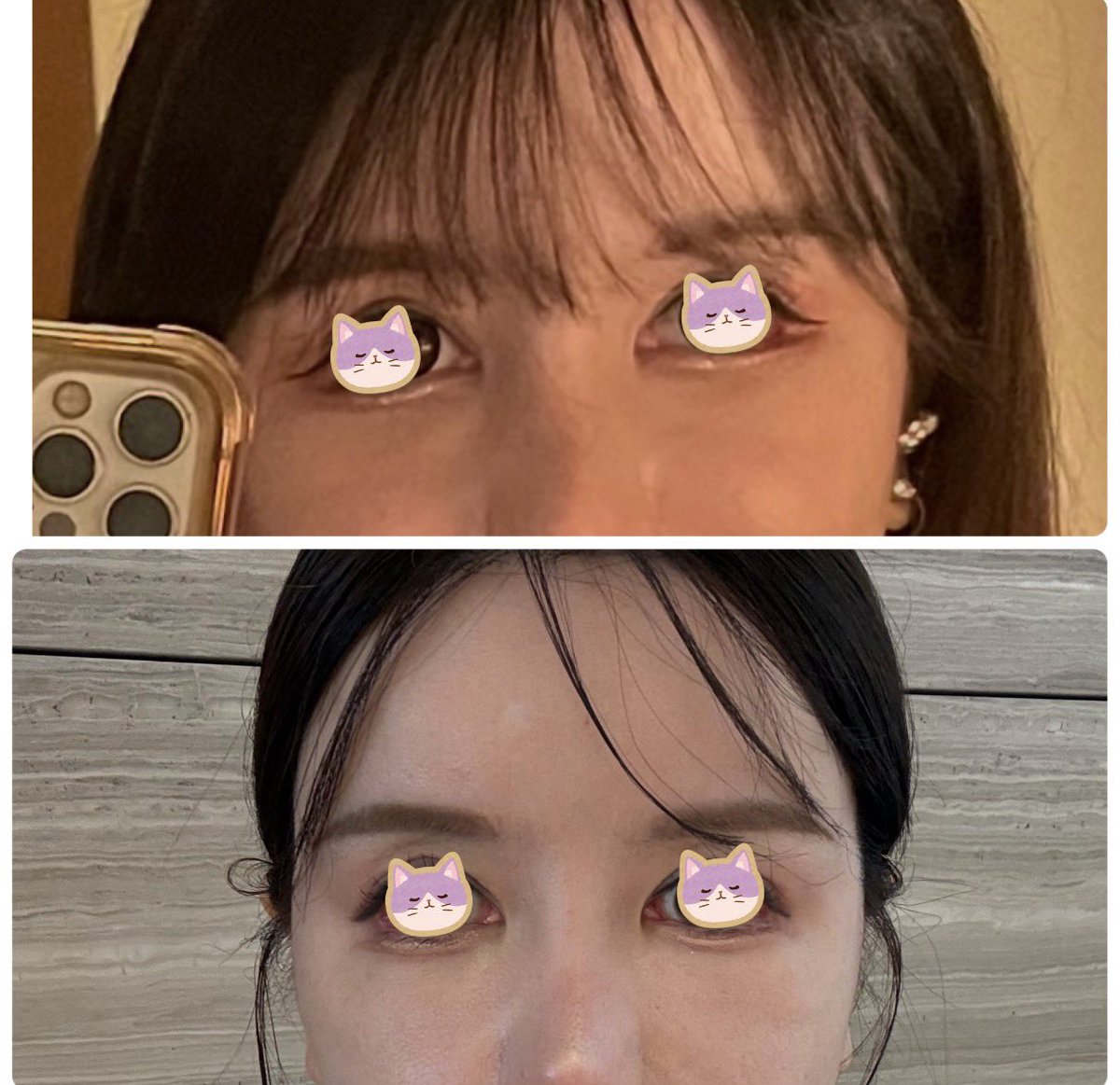 Rabichan🐰🩷整形YouTube👀 tweet media