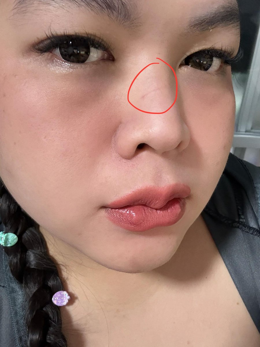 Late_kt 🍒 tweet media