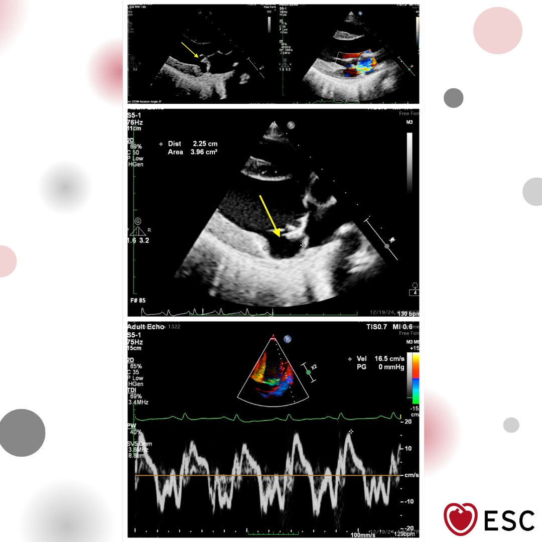 European Society of Cardiology tweet media