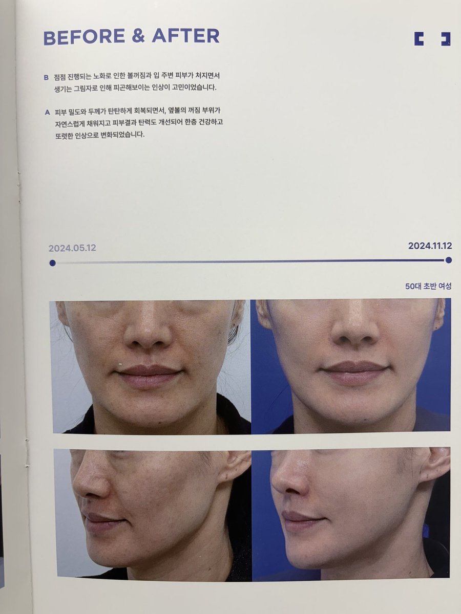 あるぱかちゃん🦙| 韓国美容 tweet media