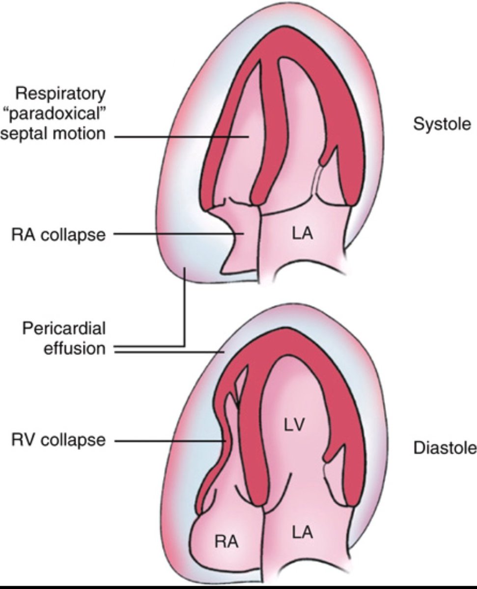 CardiovascularCorner tweet media