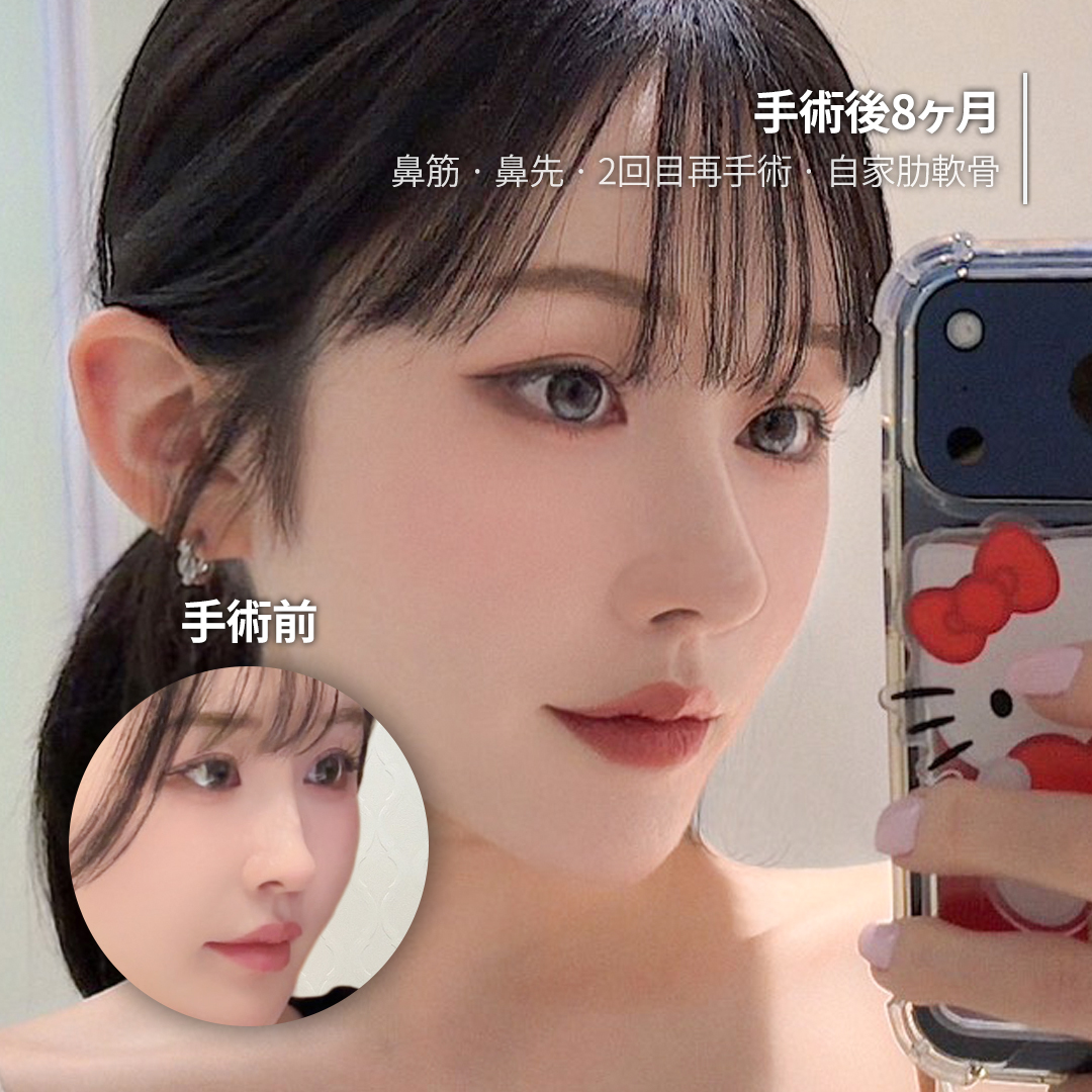 ルーヴル美容外科 tweet media