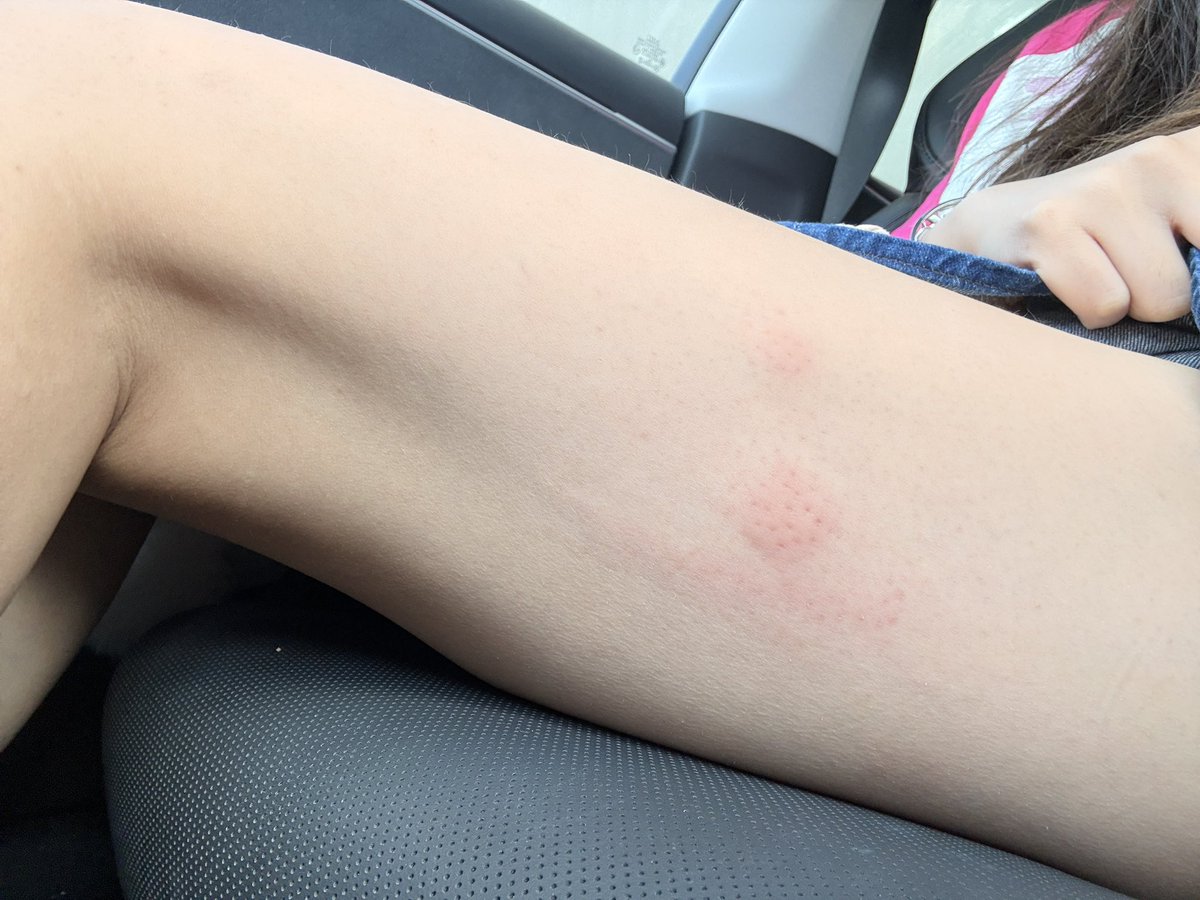 仿生云烧会梦见电子土豆吗 tweet media