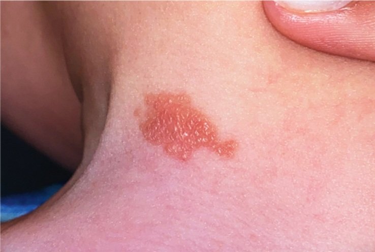 Dr sthanu subramanian tweet media