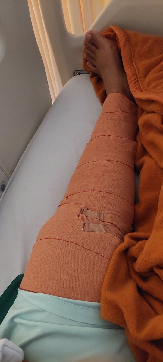 Bananacantique's tweet photo. Dokter bilang operasinya termasuk operasi kecil, battlefield nya bukan disaat operasi tapi disaat proses penyembuhan harus rutin fisioterapi. https://t.co/YVXWWqoonX