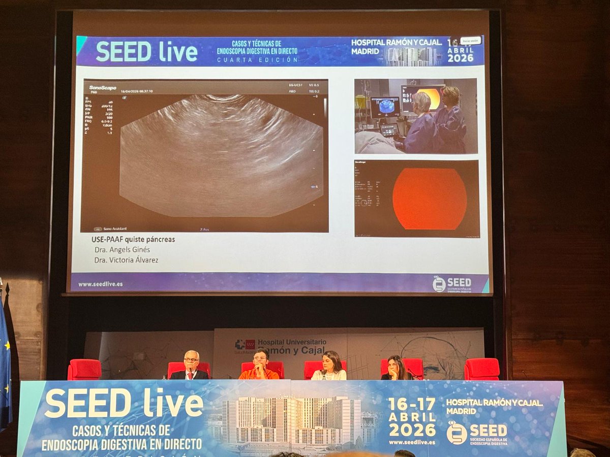 SEEDendoscopia's tweet photo. 🙌 Inauguramos la cuarta edición de #SEEDlive: el curso de casos endoscópicos en directo con el que la Sociedad Española de Endoscopia Digestiva refuerza su compromiso con una formación práctica, realista y orientada a la toma de decisiones. 

Y lo hacemos desde el Hospital Ramón y Cajal de Madrid. Durante los días 16 y 17 de abril, todos los asistentes se adentrarán en cómo pensamos y actuamos en tiempo real, cómo resolvemos dificultades técnicas y cómo abordamos incidencias que pueden aparecer durante un procedimiento, aprendiendo directamente de endoscopistas con amplia experiencia.

Toda la info en https://t.co/1R1BmMRt0d

¡Comenzamos!

#endoscopia #endoscopiadigestiva #formacion #endoscopy #endoscopistas