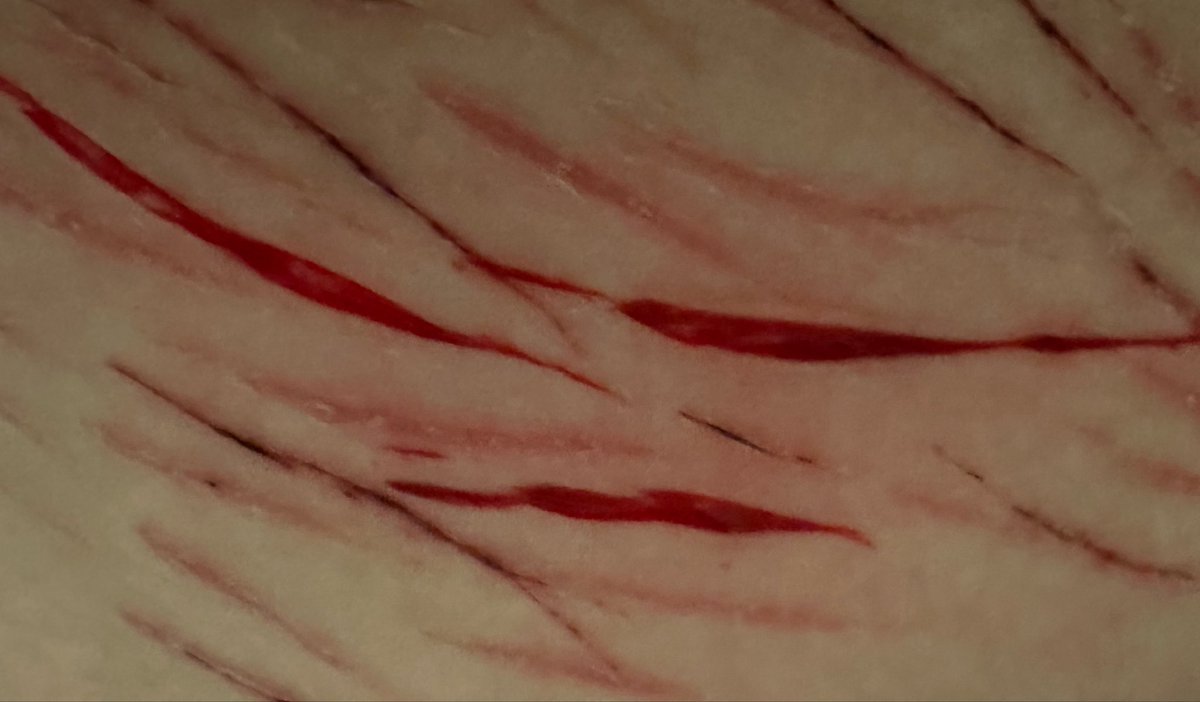 N3cro_K1tty🎀SHEDtwt tweet media