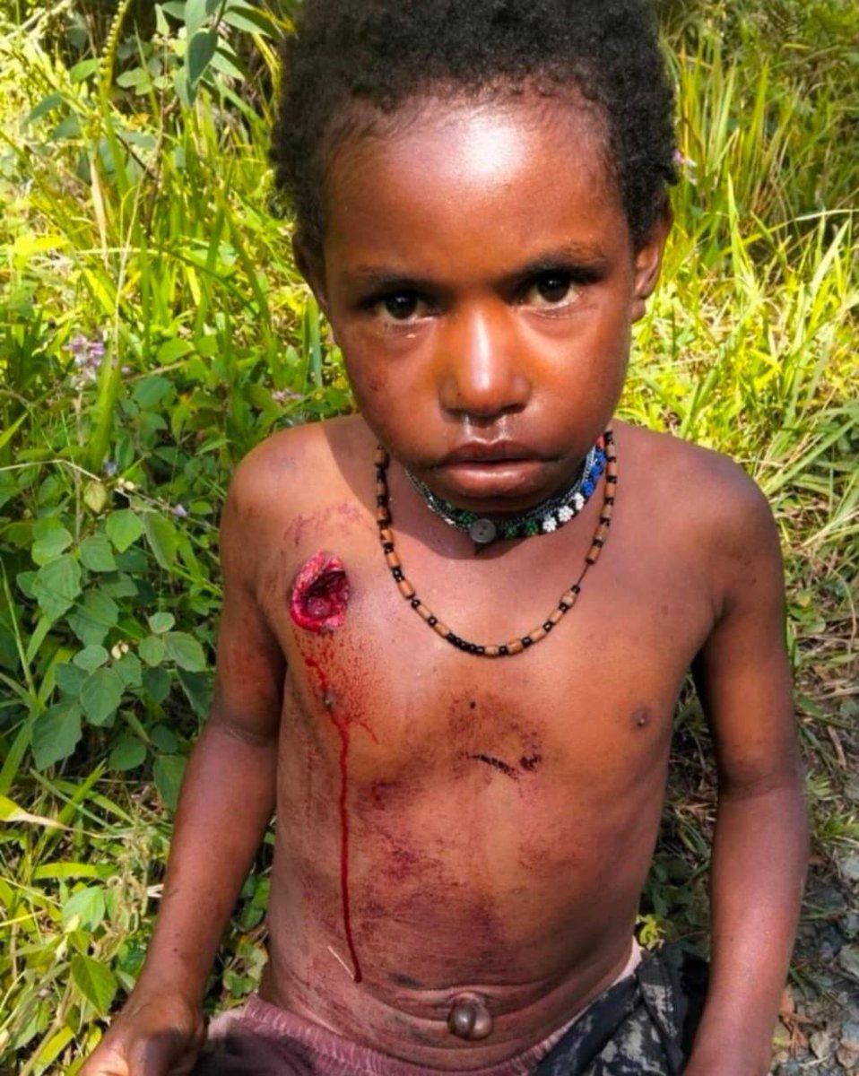 Jefry Wenda tweet media