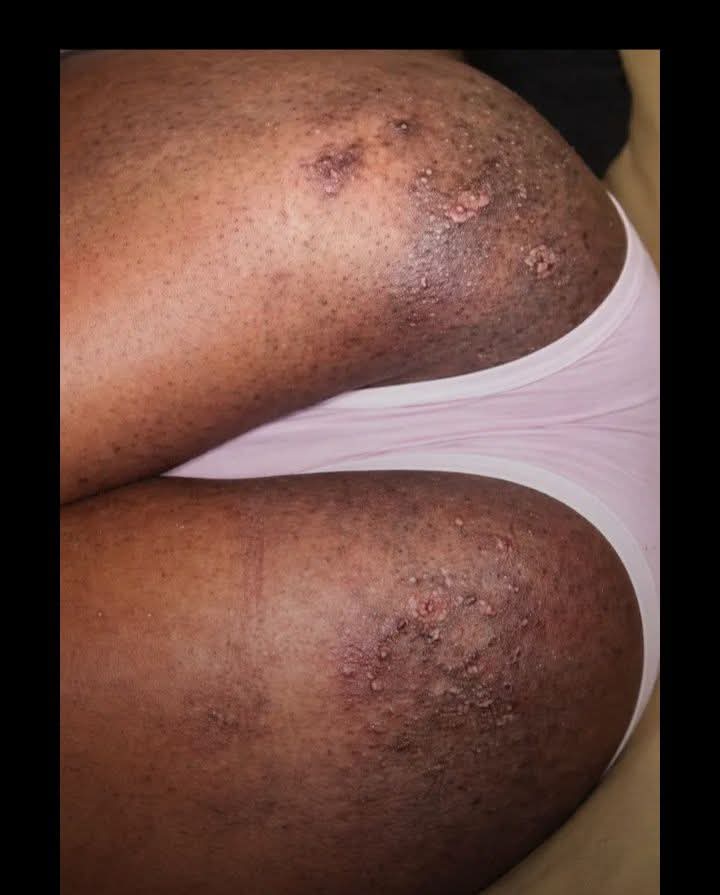 CandyLove🍭 tweet media