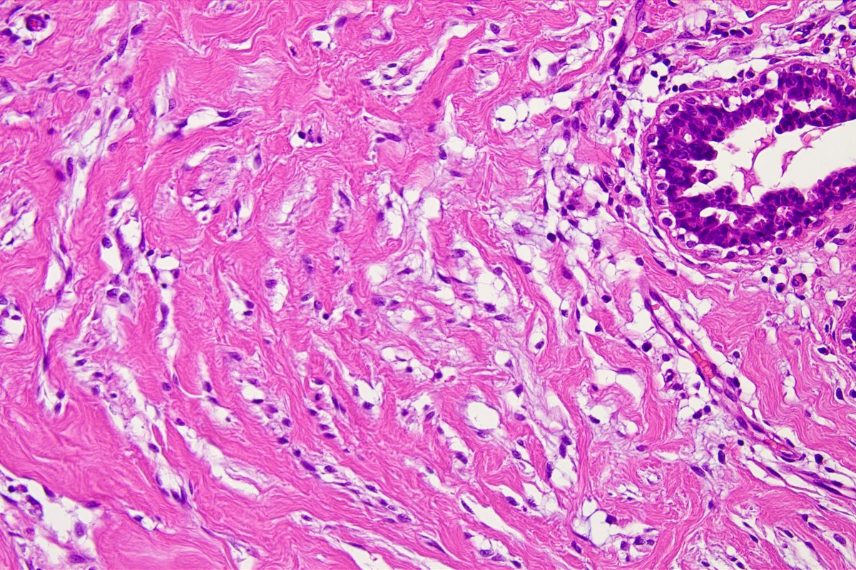 Pathology Walker@Auto Tweet Bot tweet media