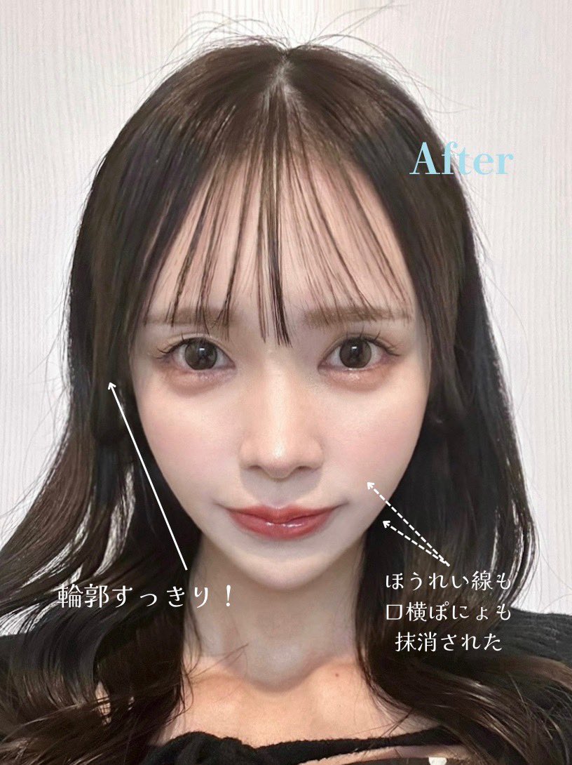 ういりん tweet media