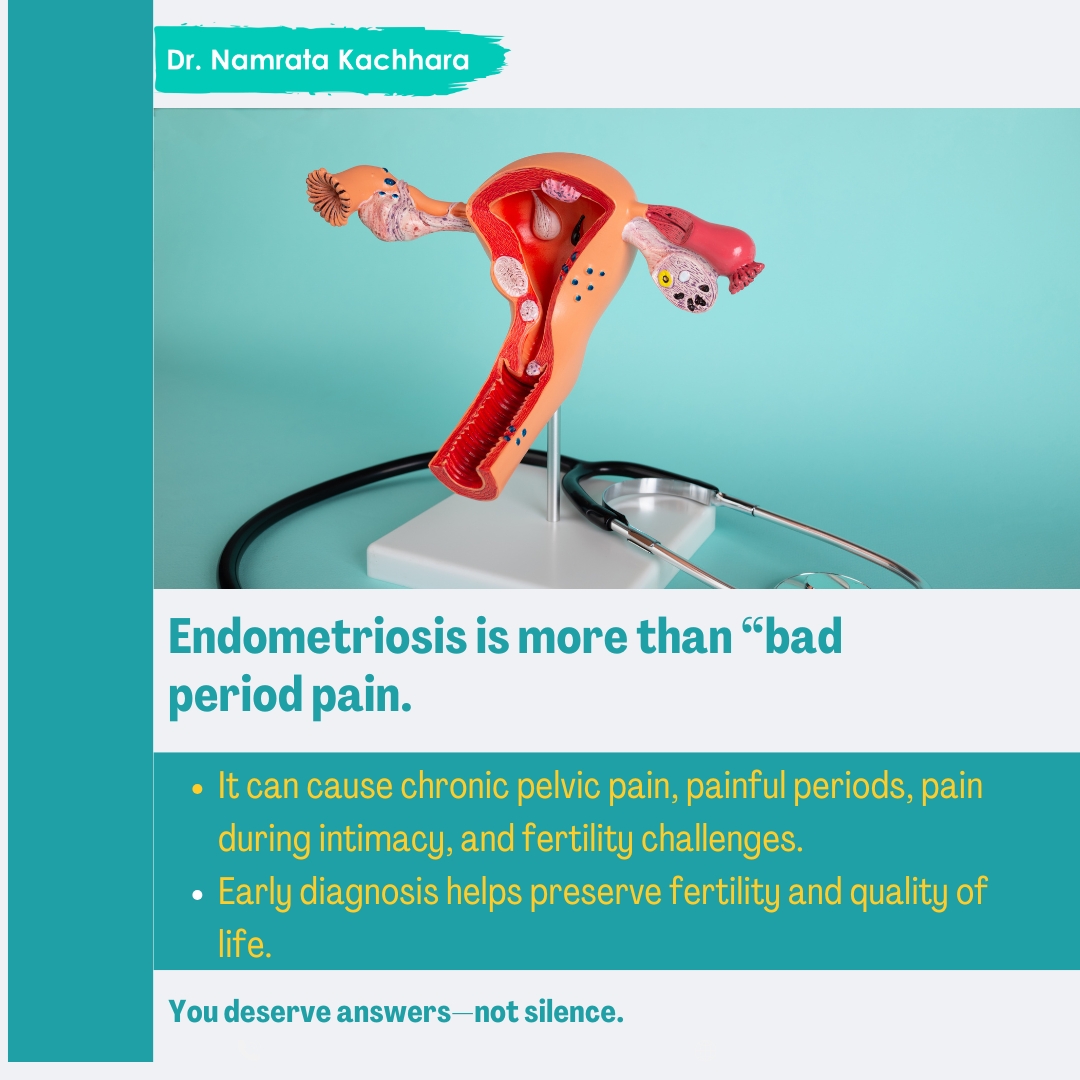 KachharaDr's tweet image. Endometriosis is not just “bad period pain”—it’s a real, often overlooked condition that can affect your daily life, relationships &amp;amp; fertility.
Don’t normalize the pain. You deserve clarity, care &amp;amp; the right support.

#EndometriosisAwareness #WomensHealthMatters #ListenToYourBody