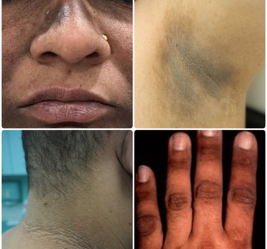 Dr. Priyam Bordoloi tweet media