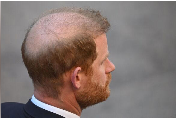 In Starmers UK, common sense is racist 😪😢😠 tweet media