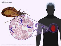 EteraHealt35393's tweet photo. Chagas disease (also called American trypanosomiasis) is a potentially life-threatening parasitic illness caused by the protozoan Trypanosoma cruzi. It is primarily transmitted by triatomine bugs, often called "kissing bugs"because they frequently bite people on the face at night https://t.co/bfiPejH9hl