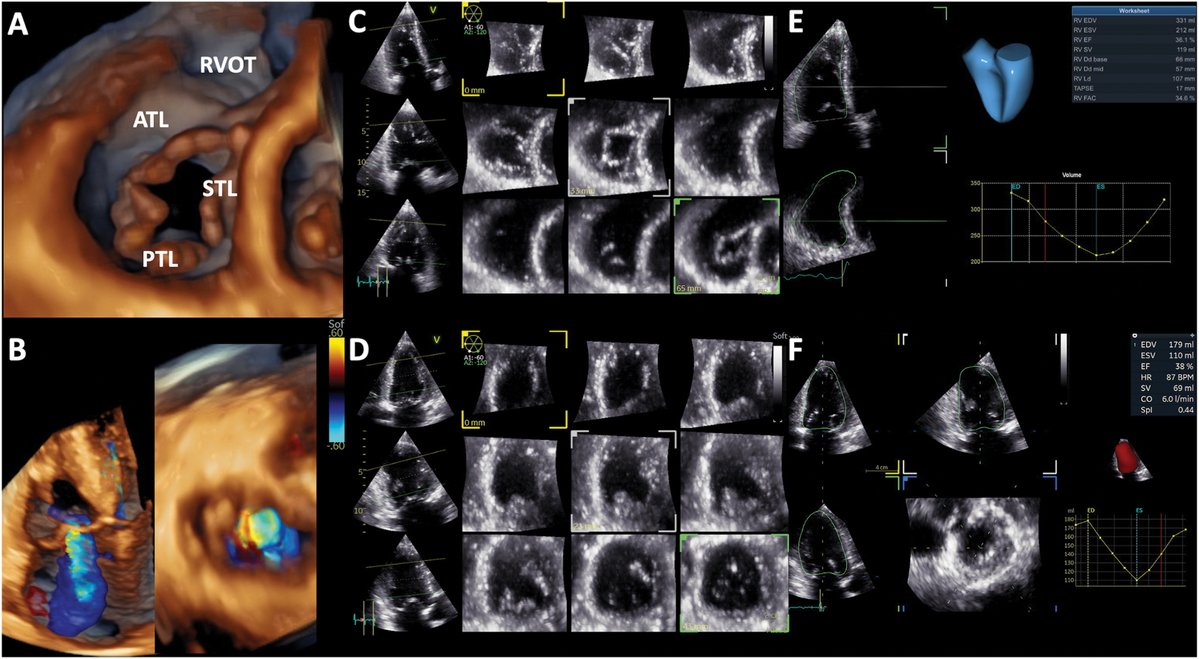 American Society of Echocardiography tweet media