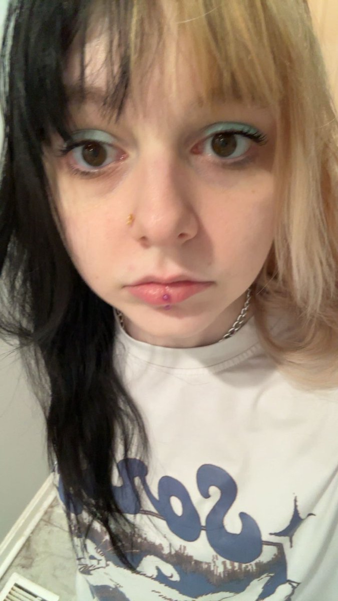 Cherie 🩻 tweet media