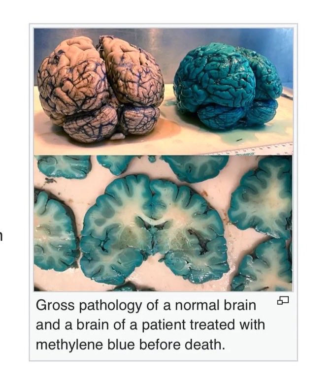 Jim Stewartson, Decelerationist 🇨🇦🇺🇦🇺🇸 tweet media
