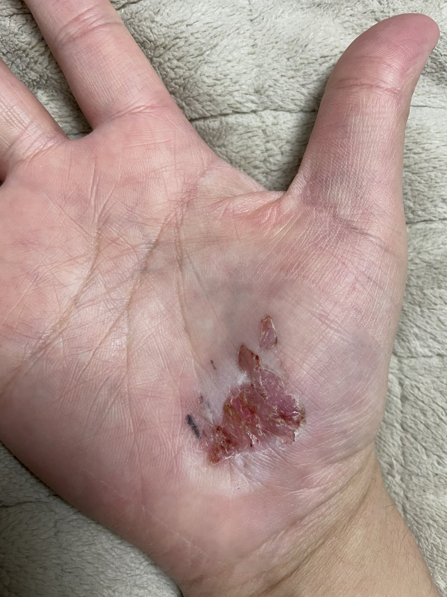 クリサリス tweet media