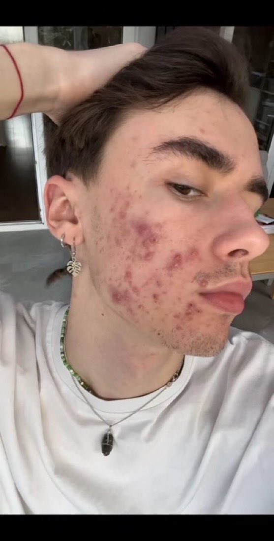 FRENCHRAPUS 🇺🇸 (secondaire) tweet media