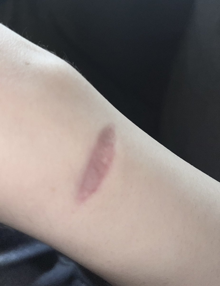 Раванел tweet media