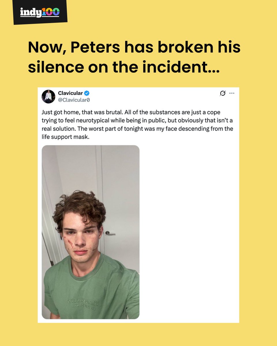 indy100's tweet image. Everything we know about 'looksmaxxing' influencer Clavicular 📱

It comes after his 14 April Kick stream came to an abrupt end while at a bar with friends.

#Influencers #Viral #SocialMedia #Clavicular #Looksmaxxing

indy100.com/viral/clavicul…