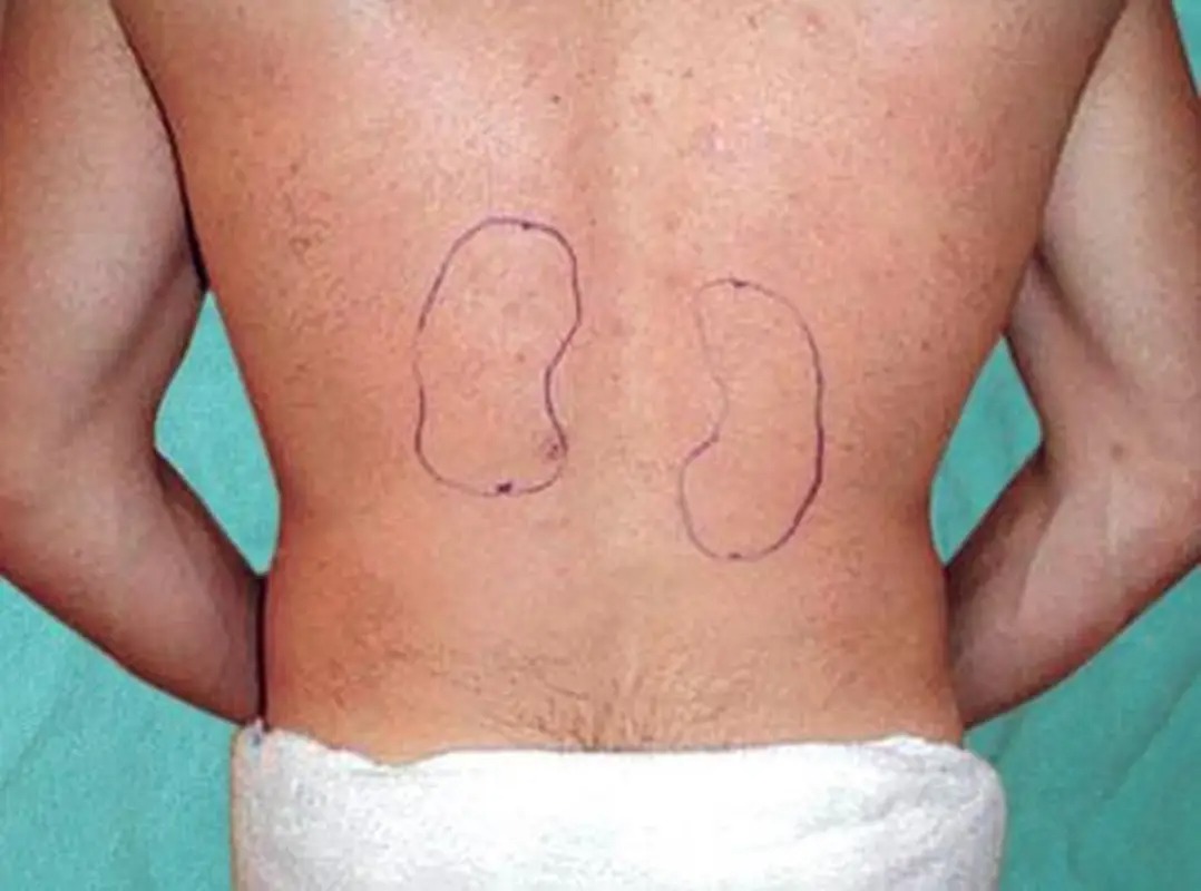 CardiovascularCorner tweet media
