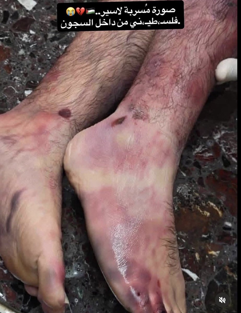 حليمة tweet media