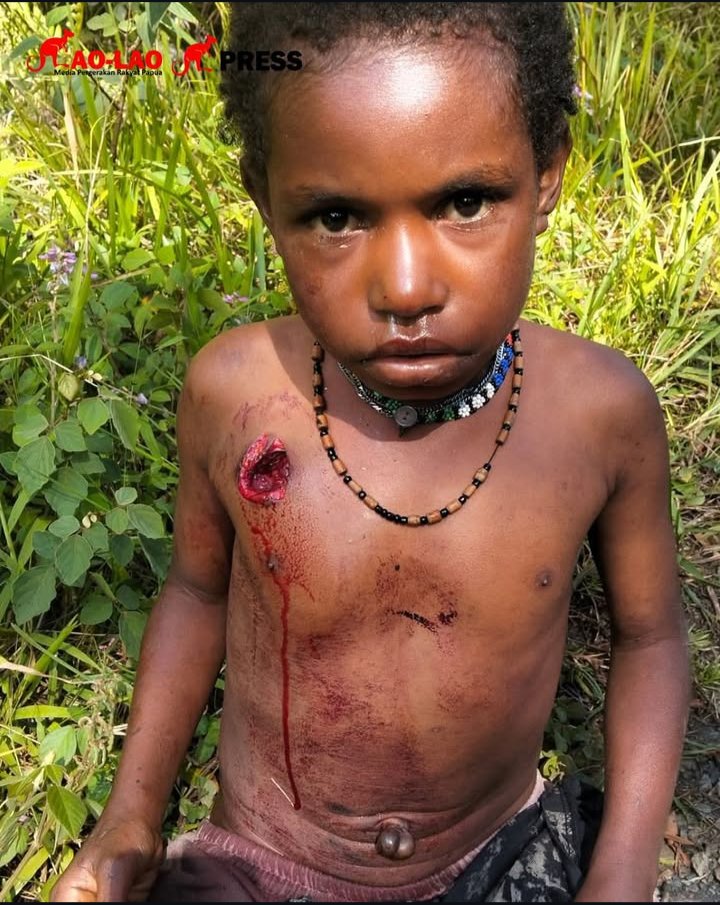 Ade kecil ini berasal Distrik Pogma wilayah konflik antara TNI vs. Pejuang Kemerdekaan TPN PB.
Ade kecil ini dng warga lainya mengungsi ke Distrik Kebru, lokasi yg su disepakati menjadi zona pengungsi. Namun hingga Distrik Kebru, militer Indo justru membantai warga pengungsi.