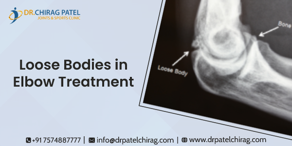 What Causes a Loose Body?

A fracture or trauma to the joint causes a loss of body in the elbow. Active people and athletes are more likely to suffer from this form of injury or discomfort since they are more likely to sustain it...

Know more at : drpatelchirag.com/blog/loose-bod…
