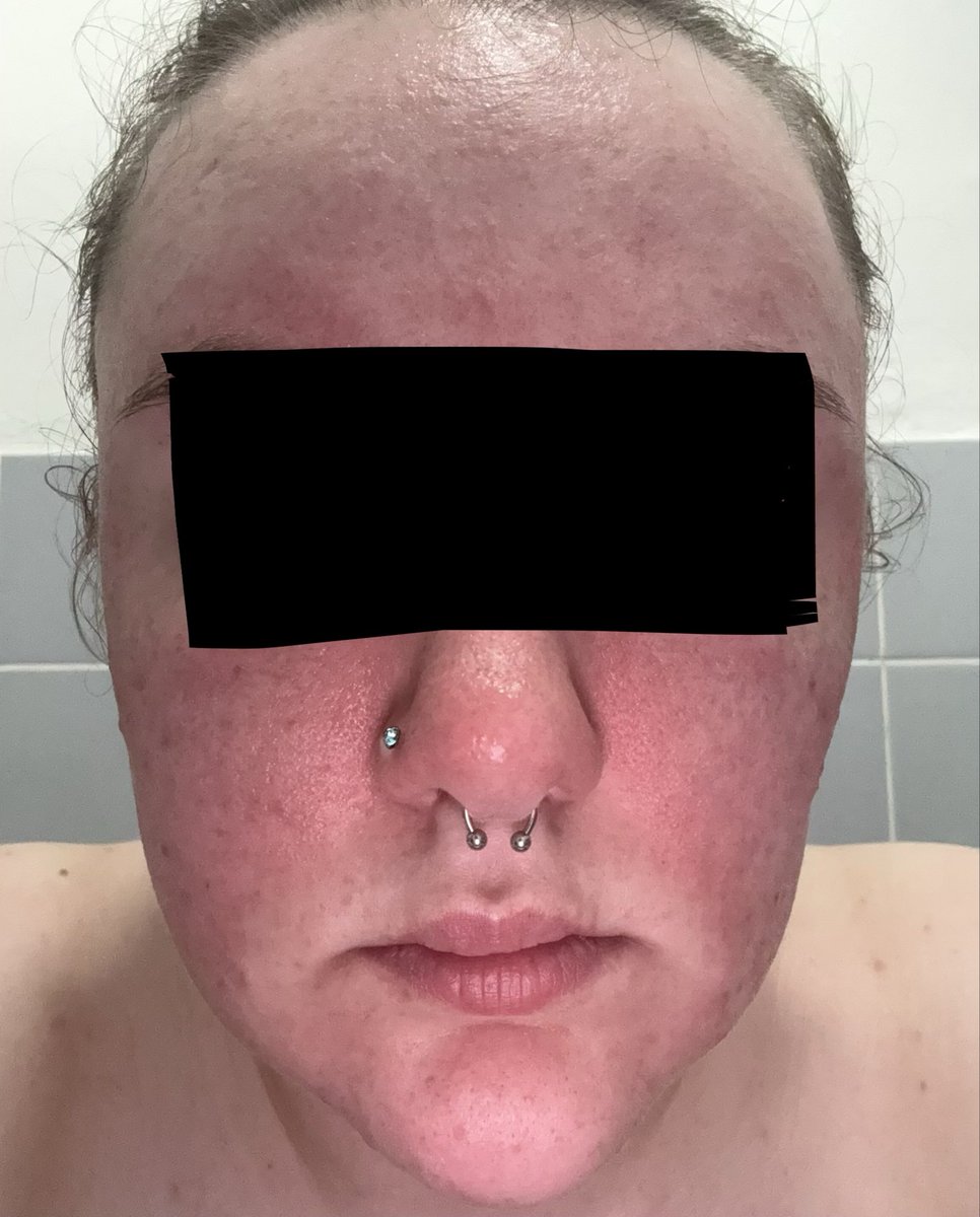 Yasmin Oldfield tweet media