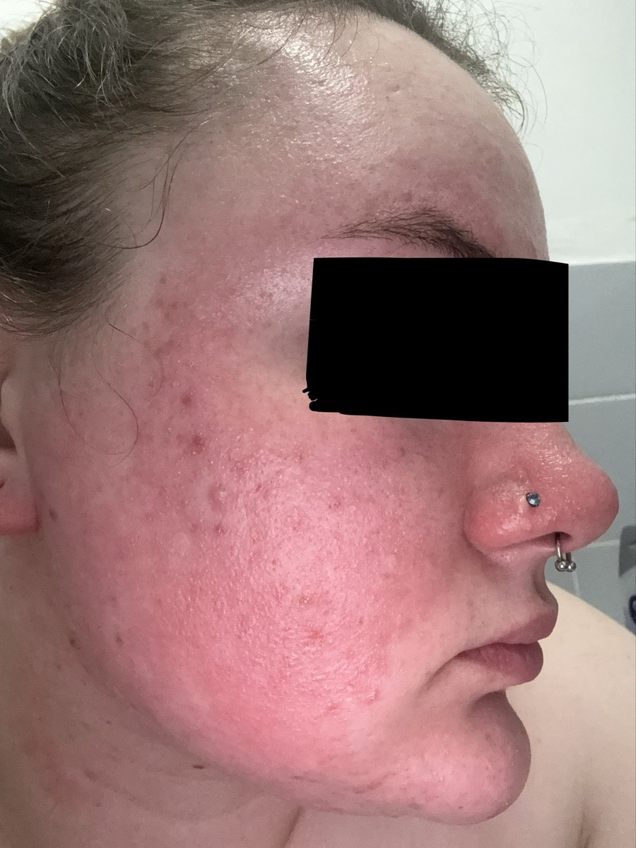 Yasmin Oldfield tweet media