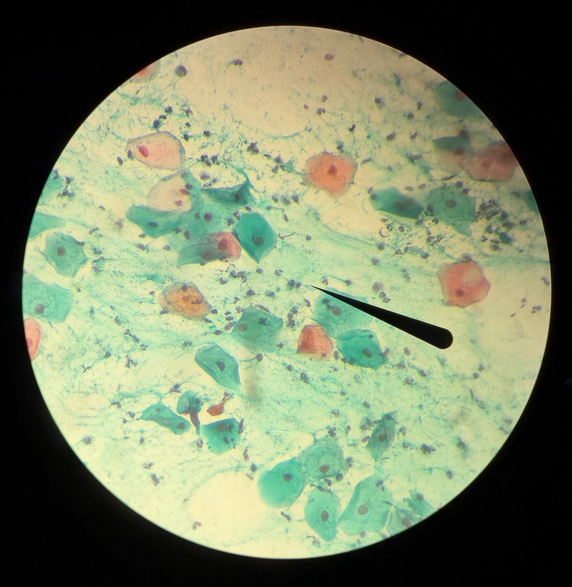 23valen_'s tweet photo. volví al laboratorio e hice técnica de papanicolaou y harris-shorr modificado y quedaron preciosas https://t.co/CLh5YM23Ky
