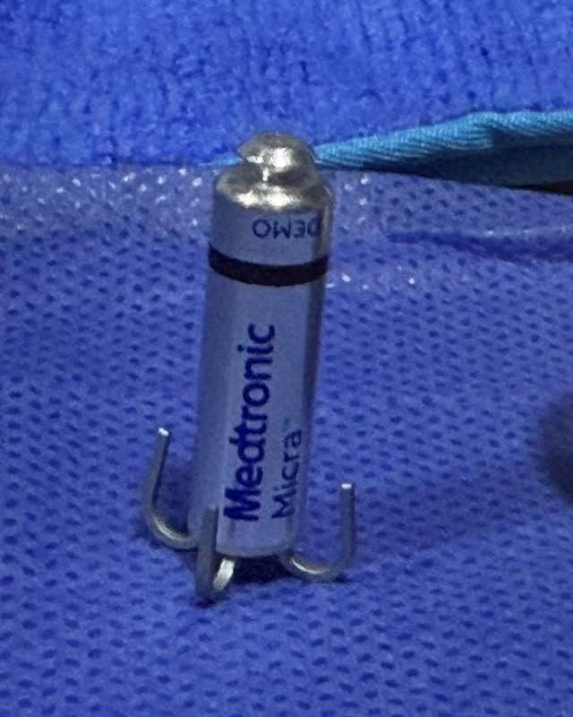 webnotitarde's tweet photo. #Salud | 🫀🏥 ¡Histórico! Implantan en el estado Monagas el marcapasos más pequeño del mundo

Por primera vez en Monagas, se realizó la implementación de un marcapasos tipo "Micra", sin cable, un procedimiento clínico que resultó de manera exitosa.

📸: RRSS https://t.co/r9L1kUVguW
