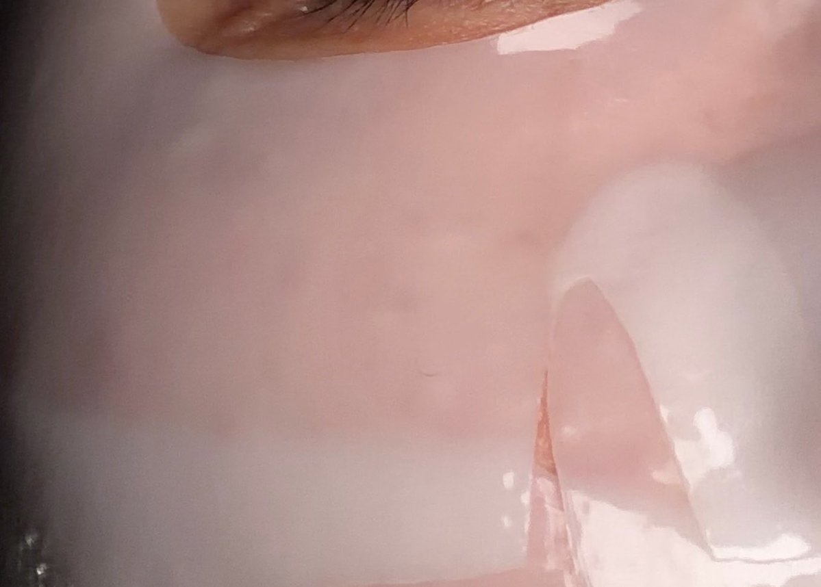 #제품제공 <a href="/dermafix_korea/">더마픽스</a>  
더마픽스 페이턴트 퍼포먼스 리얼 콜라겐 팩 
사용해보았듭니!다!
왜 유명한지 바로 납득함…💗  

겔 마스크인데 진짜 얇아서 피부에 착 달라붙고  들뜸 없이 밀착되는 느낌이 좋았음  

특히 좋았던 게 흡수력인데  
밤새 붙이는 팩보다 훨씬 빠르게 흡수돼서  
붙이고