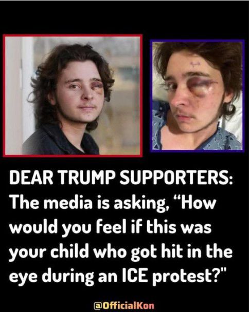 What is YOUR response to the left wing media?! 

Thoughts......??👀