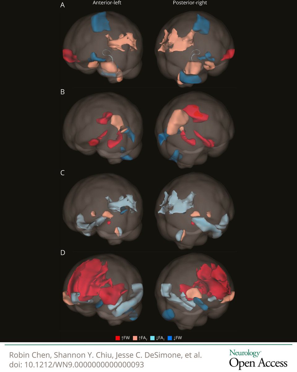 GreenJournal's tweet image. Automated Imaging Differentiation for Dementia: Including Alzheimer Disease Dementia and Dementia With Lewy Bodies hubs.la/Q04cfWrq0 

#NeuroTwitter #Dementia