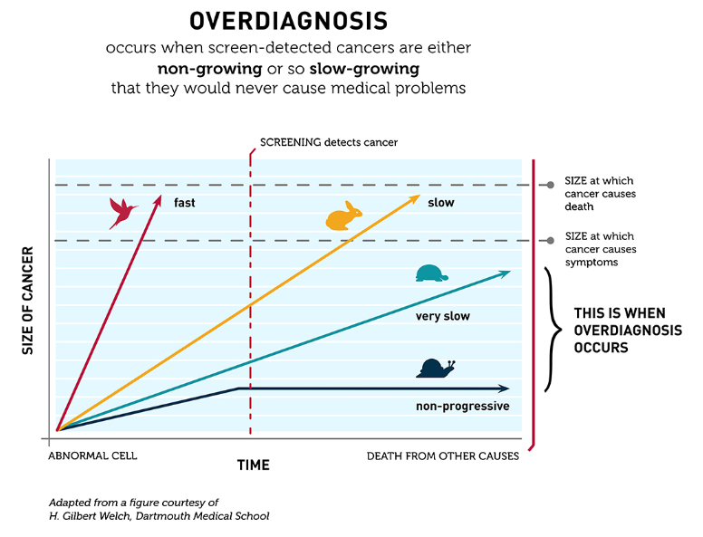 Adam_Weiner535's tweet image. For #ProstateCancer, there are three types

🐢🐇🐦‍⬛