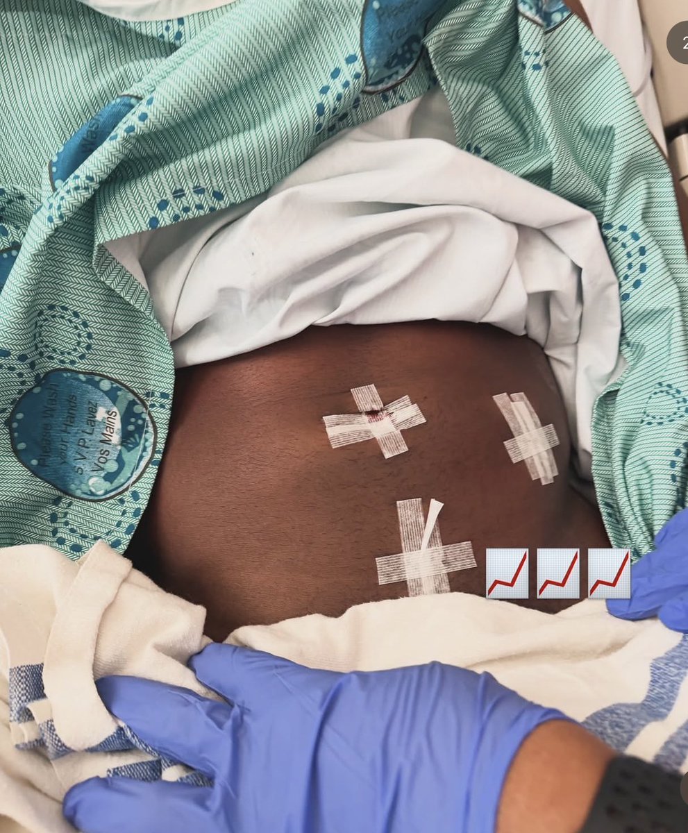 𝔸b𝕒𝕫𝕫 tweet media