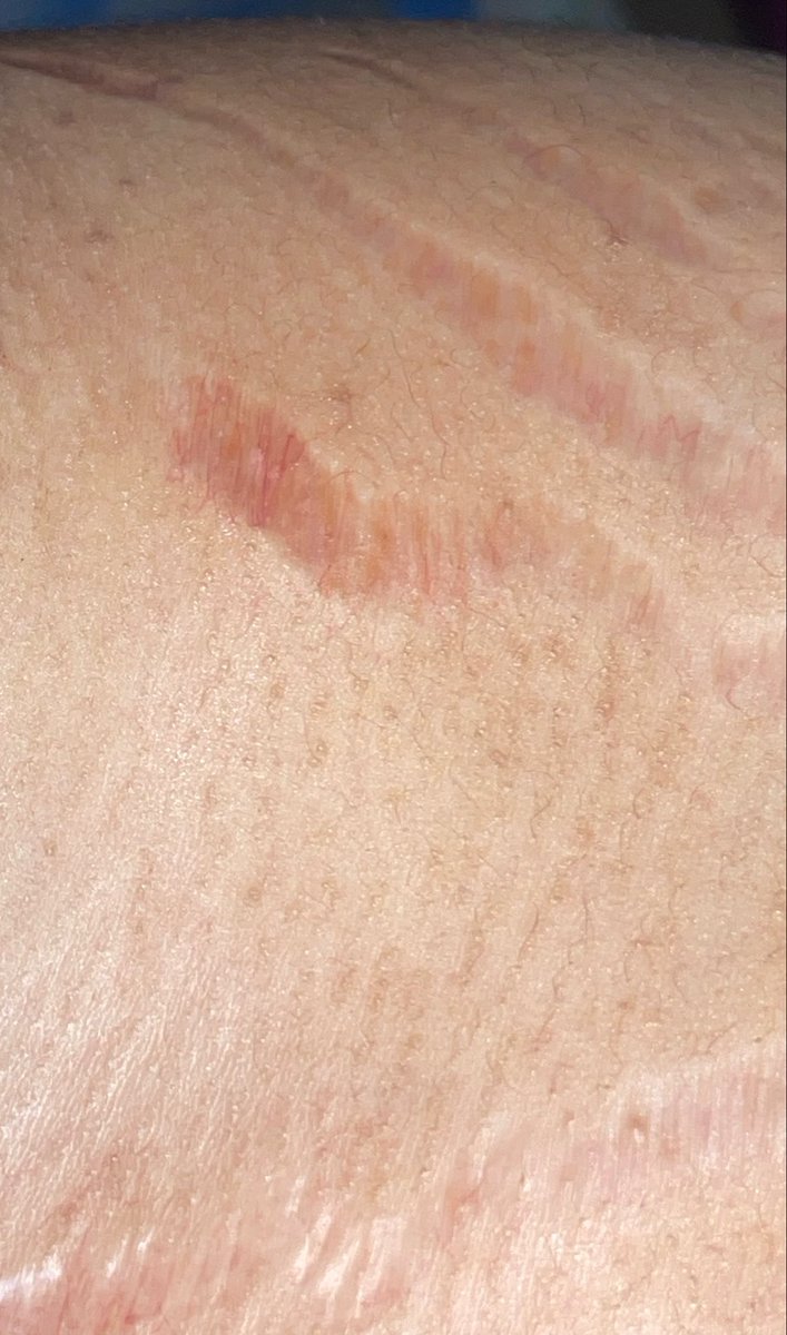 ℕ𝕦𝕣𝕤𝕖 𝔽𝕚𝕠𝕟𝕒🥹❤️💕💋 tweet media