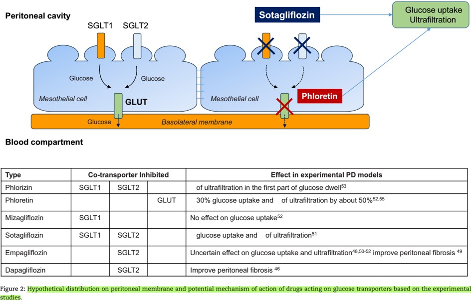Doctor_Stewie's tweet image. iSGLT2 en diálisis 🧐
#MedEd #Nephpearls

✔️Razonamiento: mecanismos pleotropicos &amp;gt;&amp;gt; ⬇️ estres oxidativo e inflamación y fibrosis renal, ⬆️ disponibilidad de ON
✔️👇🏼✍️🏽 potenciales beneficios
✔️Esperar RCT 🔜 para confirmar/validar posibles beneficios 

Minutolo et al. CKJ. 2025