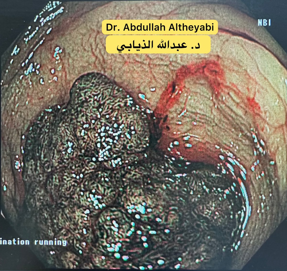 د. عبدالله الذيابي tweet media