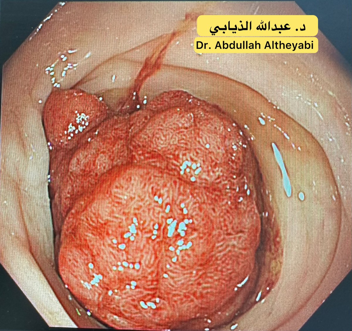د. عبدالله الذيابي tweet media