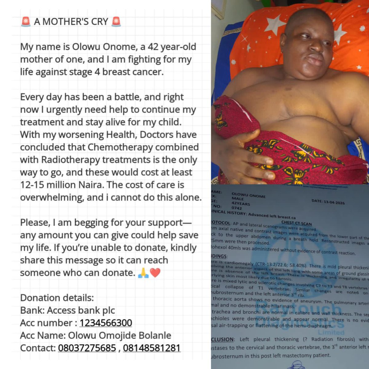 BlissByBola's tweet photo. Please Help save Mrs Onome Olowu from Stage 4 Breast Cancer 🙏🏽

*Donation Details*
*Bank:* Access Bank Plc
*Account Number:* 1234566300
*Account Name:* Olowu Omojide Bolanle
*Contact:* 08037275685, 08148581281
Every Donation and share will definitely make a difference. Thank you. https://t.co/rIGa4d52RM